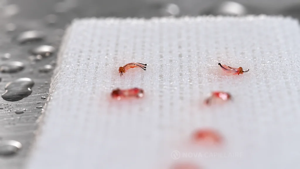 Greffons de cheveux crépus sur un plateau Greffons de cheveux crépus photographiés en macro sur une compresse humide, sur un plateau.