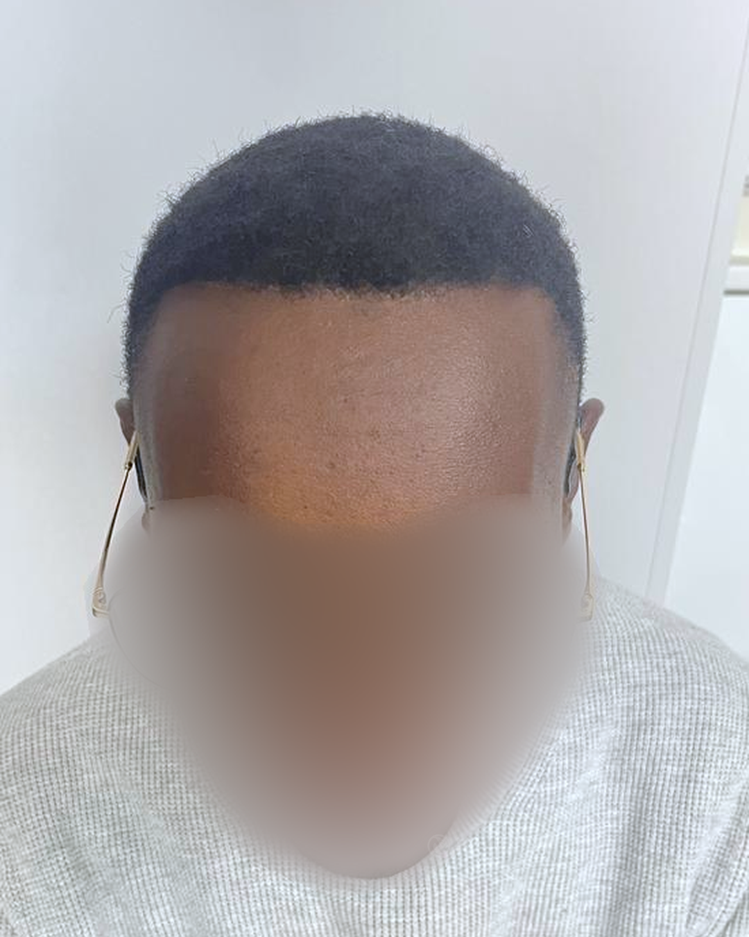 Après — 12 mois
