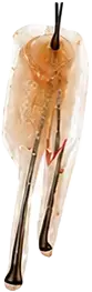 F