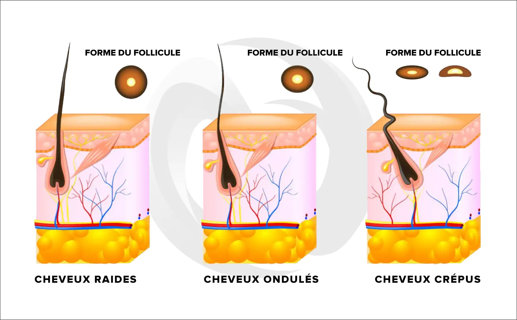 Cheveux types