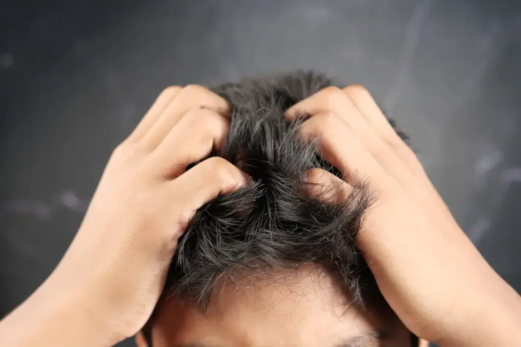 Démangeaisons après une greffe de cheveux