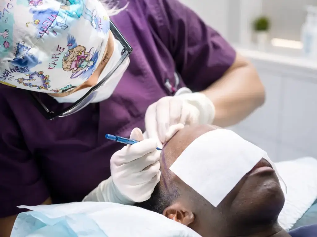 Implantation de greffons sur des cheveux crépus