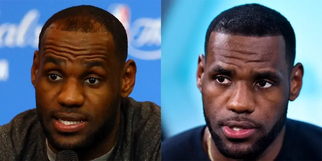 LeBron James et les rumeurs de greffe de cheveux : mythe ou réalité ?