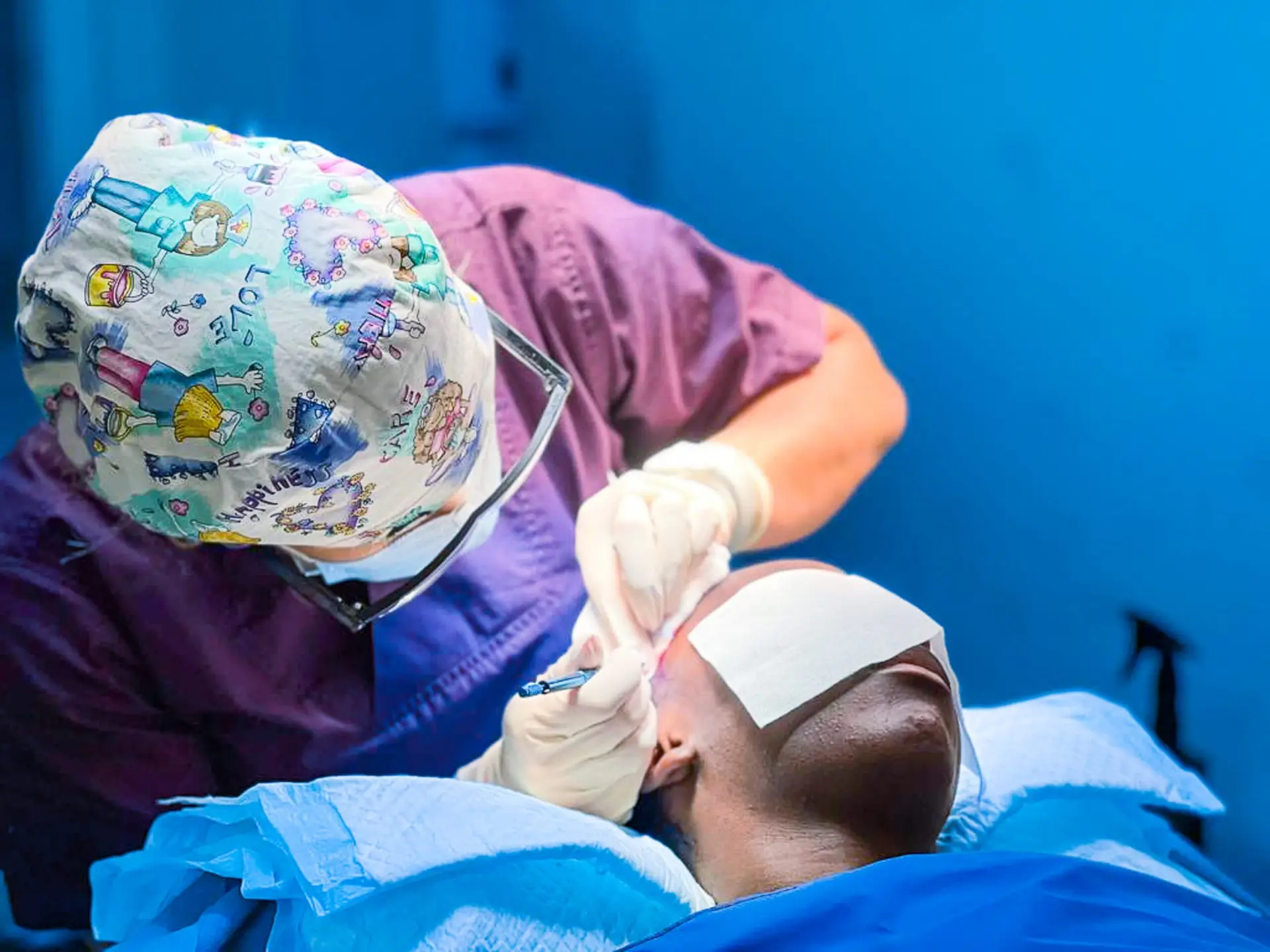 FUE Saphir (implantation d’unités folliculaires) sur cheveux afro