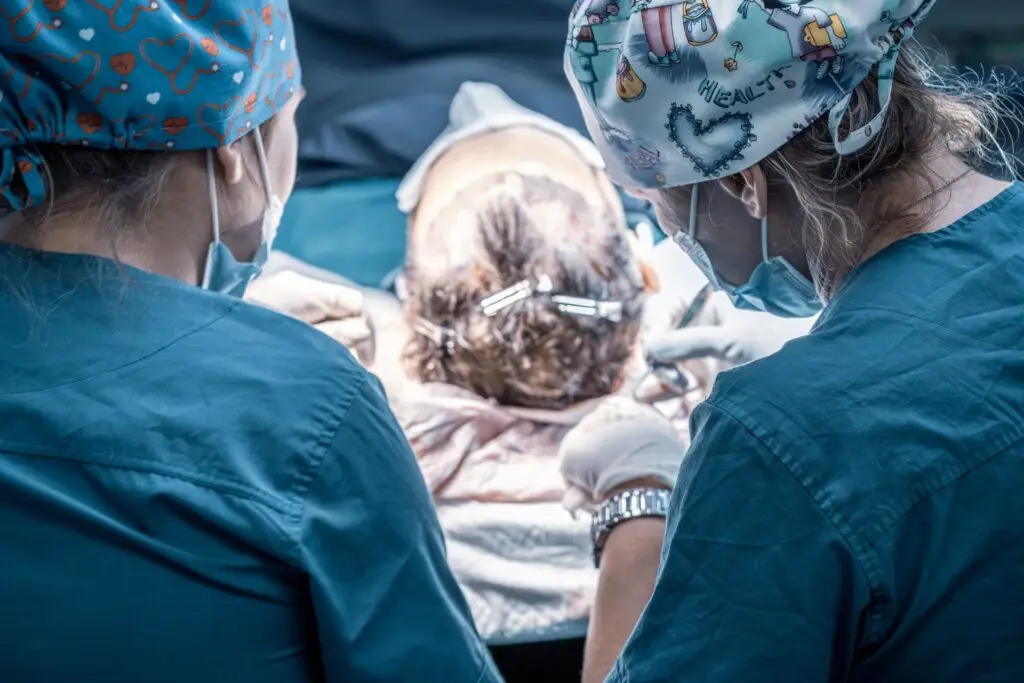 Transplantation de cheveux des régions frontales.