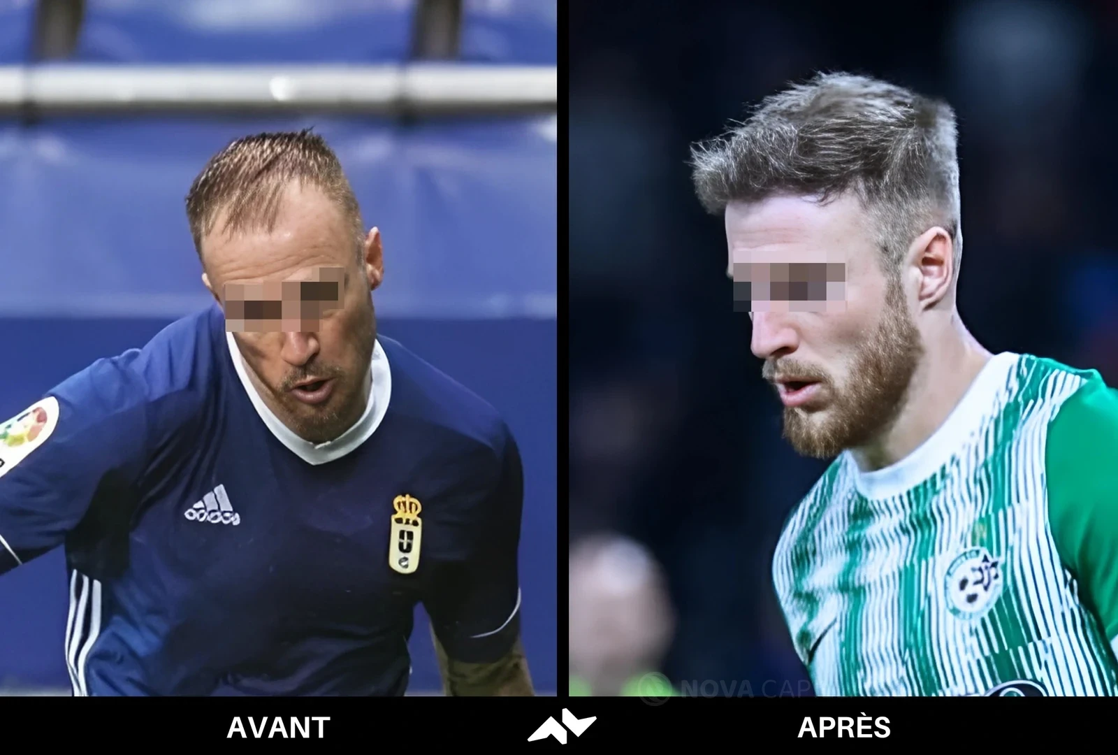 Avant, portrait avec les yeux déjà masqués