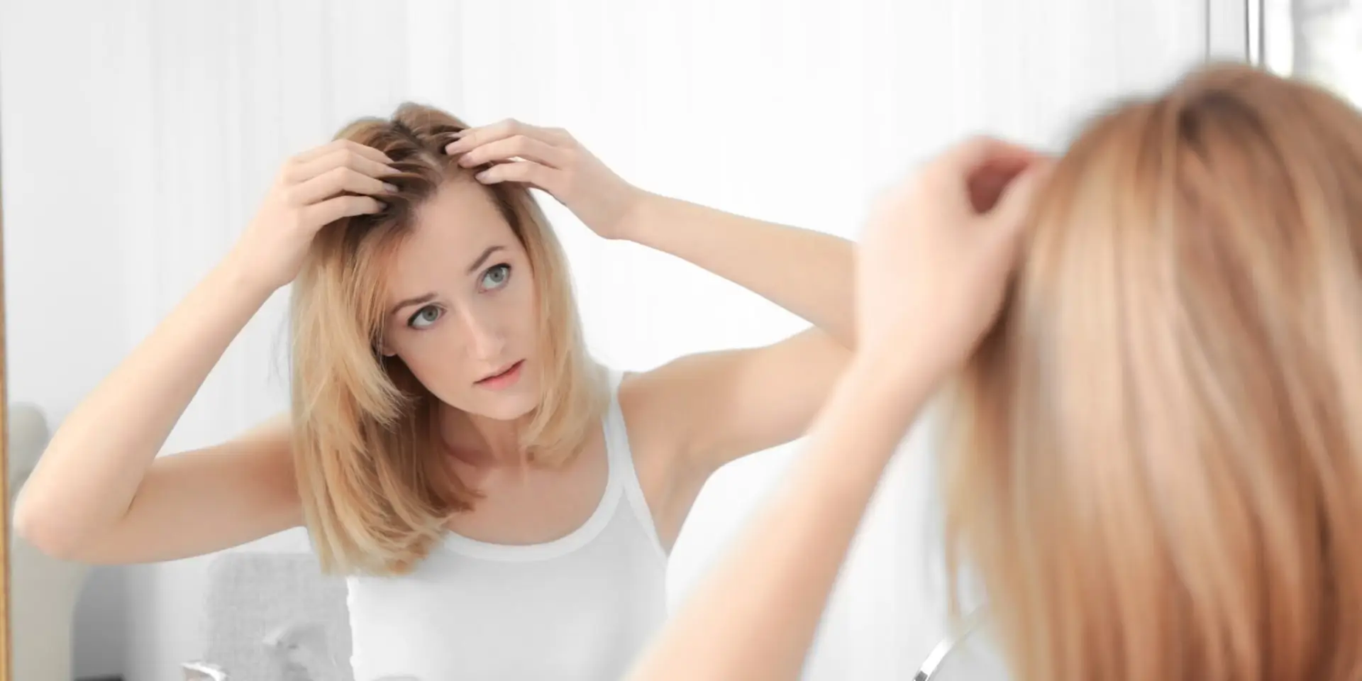 Symptômes du lupus et solutions pour limiter la perte de cheveux