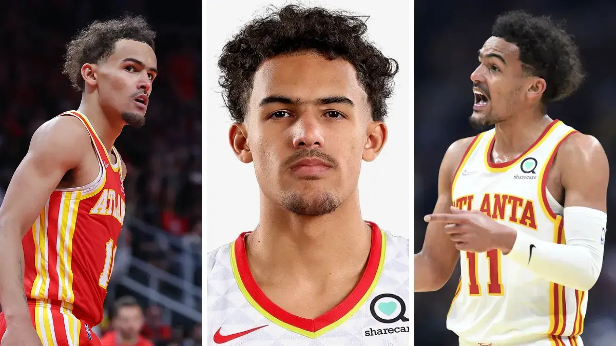 Trae Young et sa greffe de cheveux