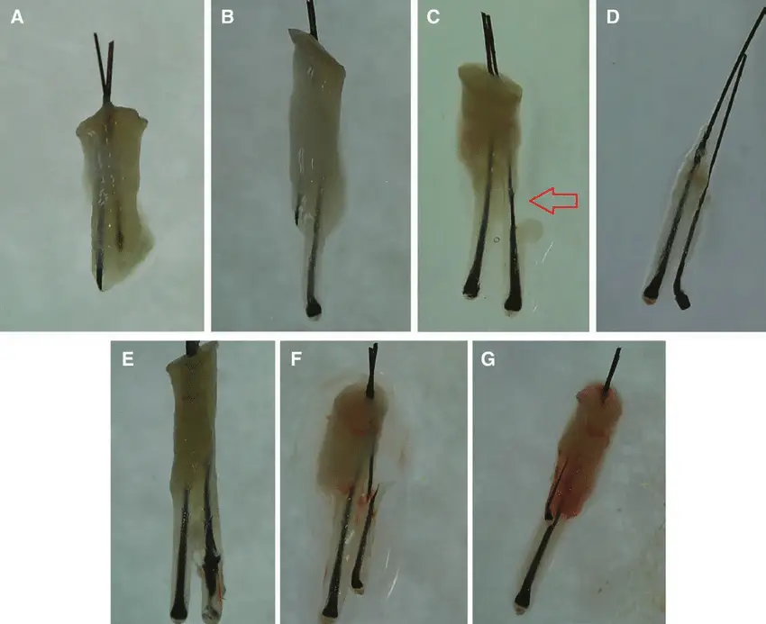 Types de lésions folliculaires susceptibles