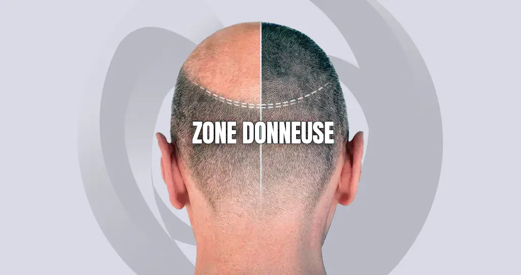 Zone Donneuse